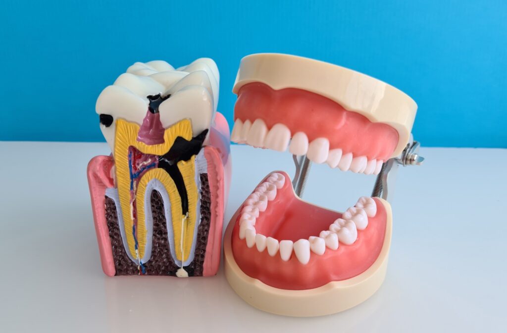 A pair of dental figurines, one showing a full set of teeth and the other displaying the internal structure of a tooth, are used to demonstrate the process of a root canal.