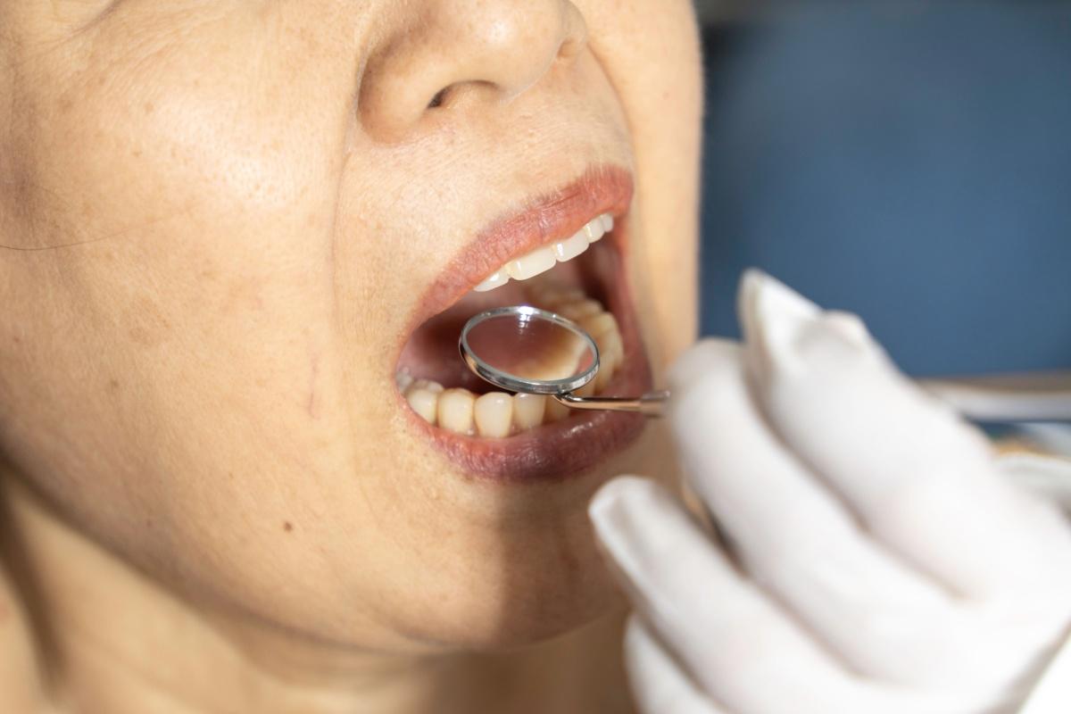 a person getting their teeth examined at the dentist